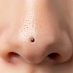 검버섯 없애는법 화장품